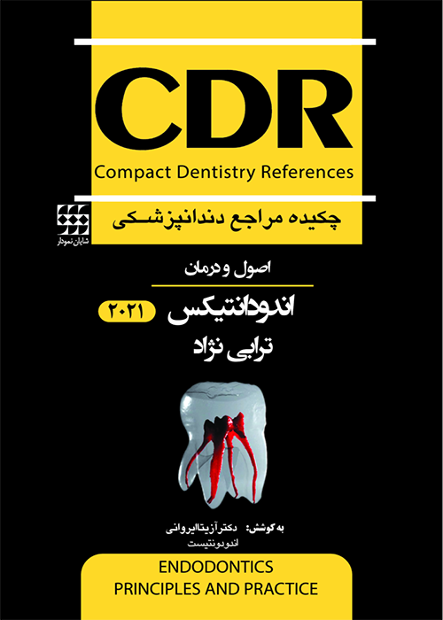 CDR چکیده مراجع دندانپزشکی اندودانتیکس ترابی نژاد 2021 شایان نمودار